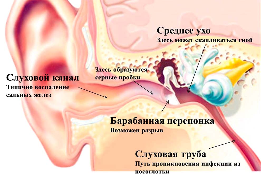 Выделения из уха